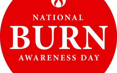 National Burn Awareness Day